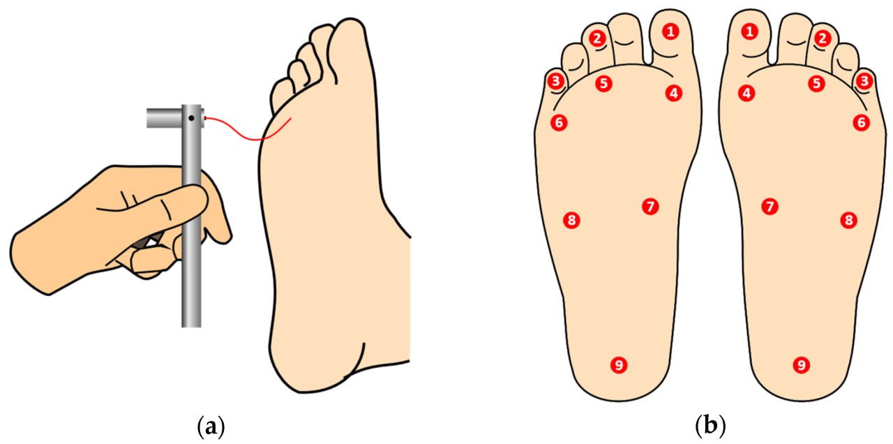 Monofilament Test Diagram